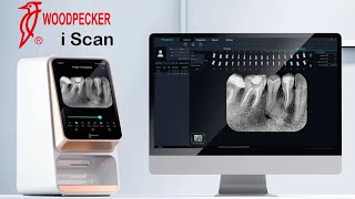 Woodpecker i Scan Nasıl Kullanılır ? - How to use i Scan Fosfor Plak Cihazı