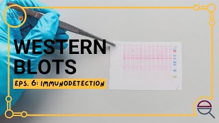 Western Blot: Introduction to Immunodetection