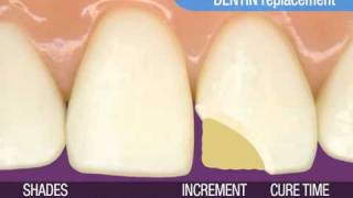 3M ESPE ● Anterior Restorations — Simple Technique