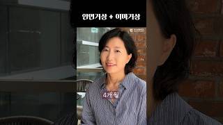 눈 뜨는 게 편해졌어요 #plasticsurgeryinkorea