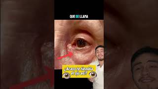 Te tiembla el ojo? #shortvideo