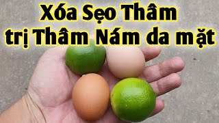 Bài thuốc trị Thâm nám da mặt, Sẹo thâm. PHAN HẢI Vlog