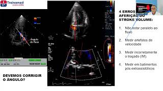 4 Erros na aferição do Stroke volume
