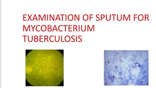 EXAMINATION OF SPUTUM FOR MYCOBACTERIUM TUBERCULOSIS