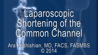 Laparoscopic Shortening of the Common Channel