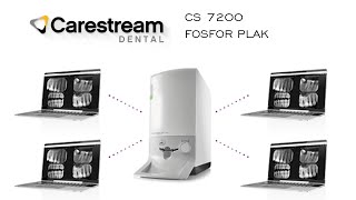 CS 7200 Fosfor Plak Cihazı