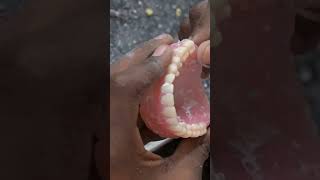 full denture dant kaise banate Hain/ how to make tooth 🦷