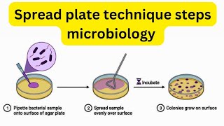 Spread plate technique principle procedure steps in microbiology | #labtech #microbiologyclass