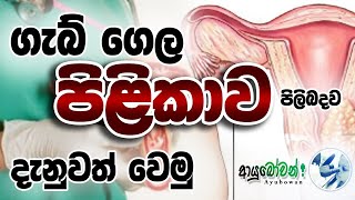 ගැබ් ගෙල පිලිකාව පිලිබදව දැනුවත් වෙමු | Be cancer aware| Cervical cancer | AYUBOWAN|ආයුබෝවන් |