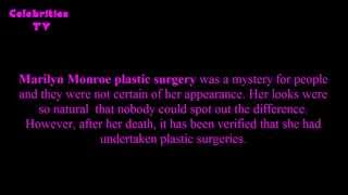 Marilyn Monroe, pionnière de la chirurgie plastique !