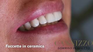 Faccette dentali - estetica dentale