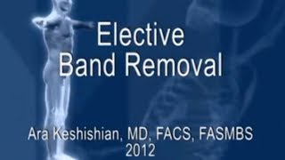 Elective Lap-Band® Removal