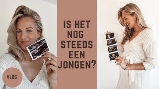 20 WEKEN ZWANGER!🤰last van bekken instabiliteit 😖