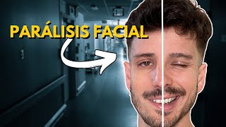 Qué Hacer si Tienes PARÁLISIS FACIAL | Tratamiento y Consejos