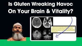 Is Gluten Wreaking Havoc On Your Brain & Vitality?