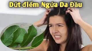 Dứt điểm Ngứa da Đầu, Gàu, viêm Da Đầu bằng bài thuốc Đơn giản | PHAN HẢI Vlog