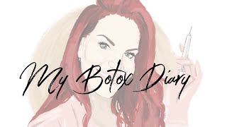 My Botox Diary