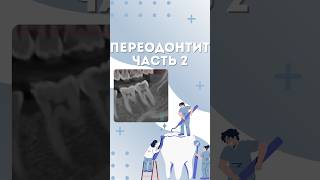 ПЕРИОДОНТИТ часть 2