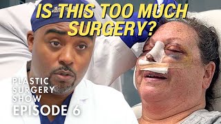 8 Surgeries In 2 Months?!  || Beyond the Surface (S1 Ep6)