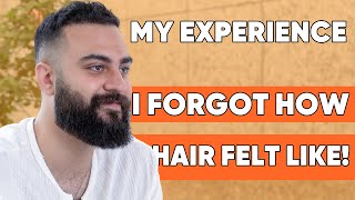 My Expedience With Hair Transplant | Ismail After 6 MONTHS OF HAIR TRANSPLANT!