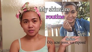 Skincare Routine for a clear face.