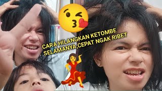 TIPS//CARA,AMPUH HILANGKAN KETOMBE//CEPAT//NGAK PAKAI RIBET