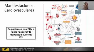 Sistemática de Seguimiento cardiológico post-COVID