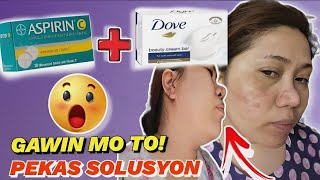 ASPIRIN + DOVE para sa Pekas araw araw mong gawin para sa PEKAS!