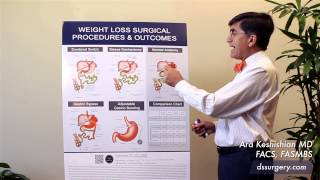 Weight Loss Surgical Procedures Part 1- Normal Anatomy