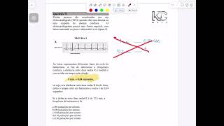 Q73 Muitas pessoas são monitoradas por umeletrocardiógrafo (ECG) quando têm uma doença ouuma suspei