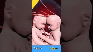 #shortsvideo #twinsbaby #shortfeeds #mbbslove #anatomyhub #labtech