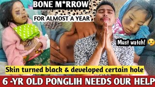 6 -Yr Old Little Girl, Ponglih needs your help|| Must Watch!