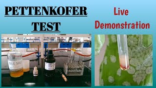 Pettenkofer test || Bile salts in urine || #Biochemistry