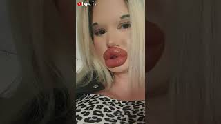 Ella Tiene los Labios Más GRANDES del Mundo 👄