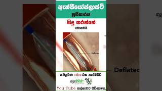 හදවතේ අවහිරතා/Blocks යතාතත්වයට පත් කරන ඇන්ජියෝප්ලාස්ටි/Angioplasty| MLTAnushikaPerera 11:11.