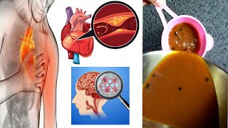 Het drankje verhoogt de gezondheid van het hart, hersencellen schade voorkomen en atherosclerose