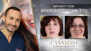 Intervento Completo di Implantologia Dentale - Cannizzo Studio