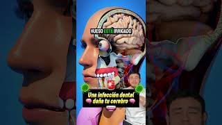 Son p3ligros4s las caries? #shortvideo