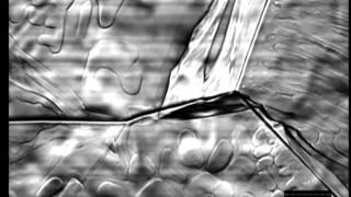 Massive-type phase transformation of steel | Confocal Microscopy