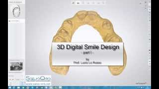 3D digital smile design