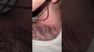 Ingrown cly hair problem #hair #hairsalon #hairandbeard