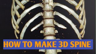 HOW TO MAKE 3D SPINE #SPINE 3D