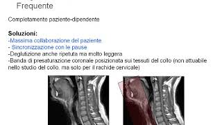 Corso RM FAD 2015 -    riduzione degli artefatti da movimento