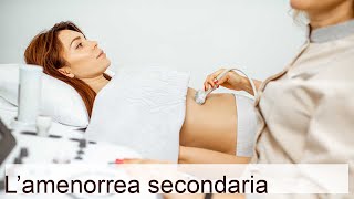 Amenorrea secondaria: cause e diagnosi