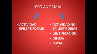 Electroencefalografia Dr Martinez