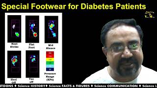 Special Footwear Developed by Indian Scientists for Diabetes Patients