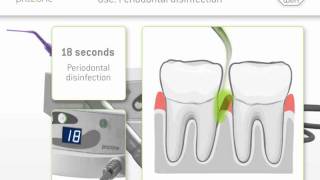 W&H ● Prozone - 18 seconds periodontal disinfection