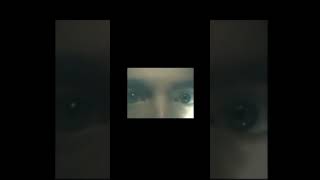 Direct and consensual pupillary light response #shorts #viral