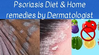 Psoriasis diet and home remedies by Dermatologist/ what foods to eat and what not to eat/