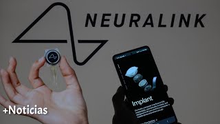 Neuralink recibe la autorización para probar su chip cerebral para mover brazos robóticos